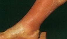 Circulation