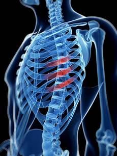 ribs