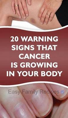 Warning Signs