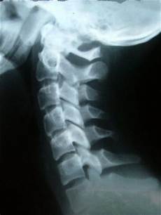 X Ray