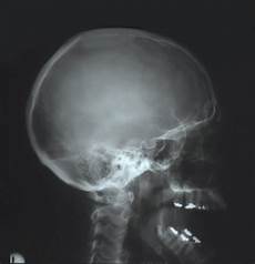 X Ray