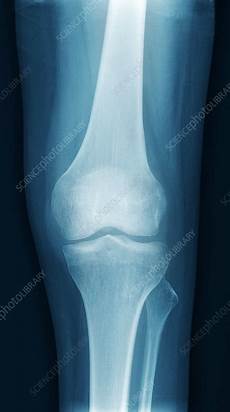 X Ray