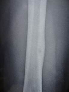 X Ray